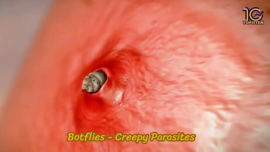 Botflies - Creepy Parasites 